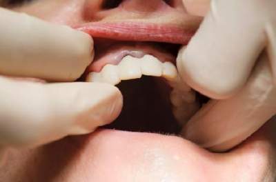 Стоматолог рассказал, как сохранить все зубы до старости